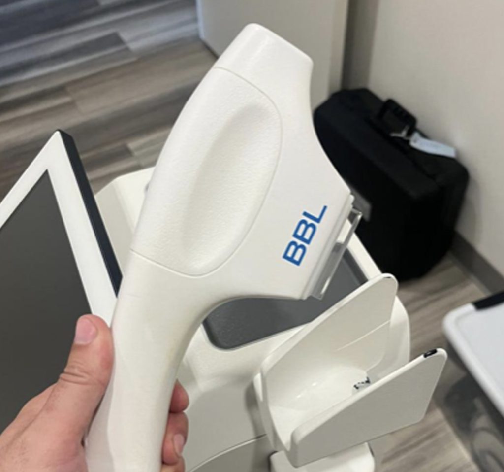 Sciton Laser Hair Reduction