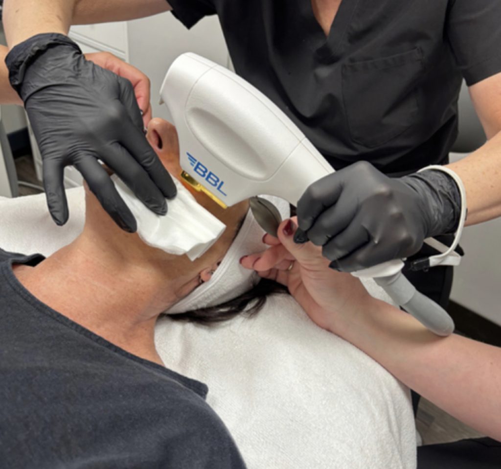 Skin Procedures