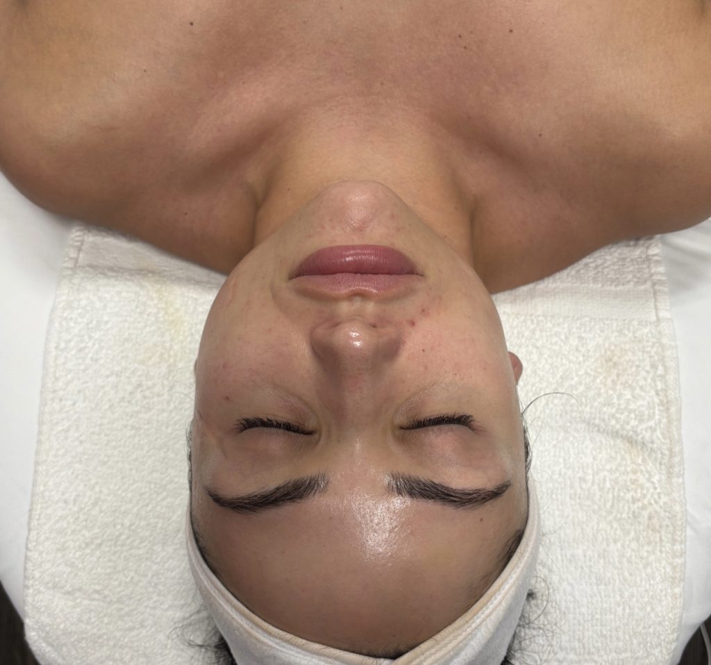 Teen Facial Services
